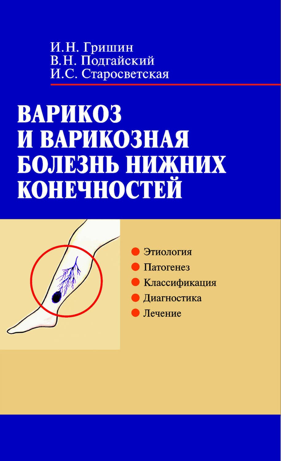 Обложка книги «Варикоз и варикозная болезнь нижних конечностей» — Игорь Гришин