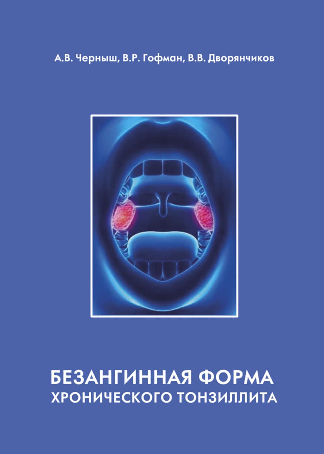 Обложка книги «Безангинная форма хронического тонзиллита» — Валерий Гофман
