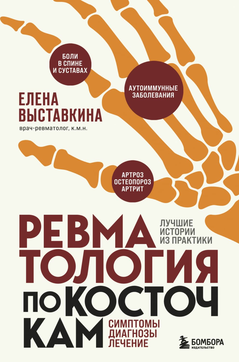Обложка книги «Ревматология по косточкам. Симптомы, диагнозы, лечение» — Елена Выставкина