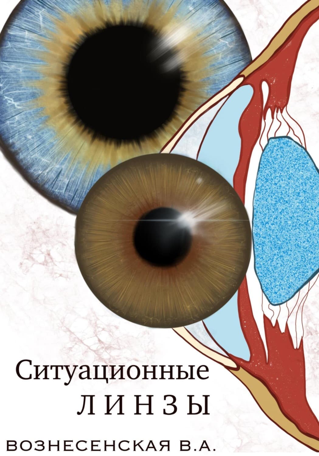 Обложка книги «Ситуационные линзы» — Вилата Вознесенская